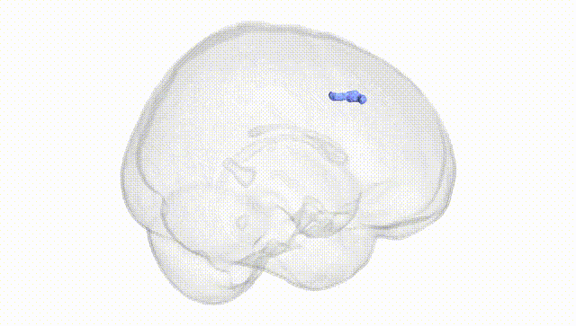 Full Brain White