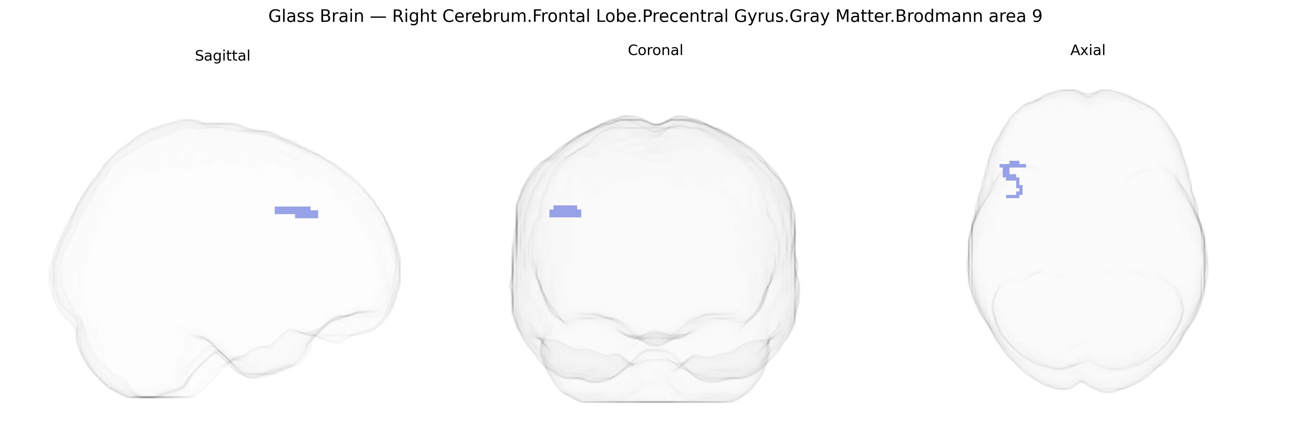 Triplanar Ghost Brain