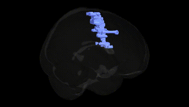 Full Brain Black