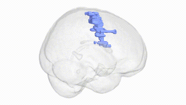 Full Brain White