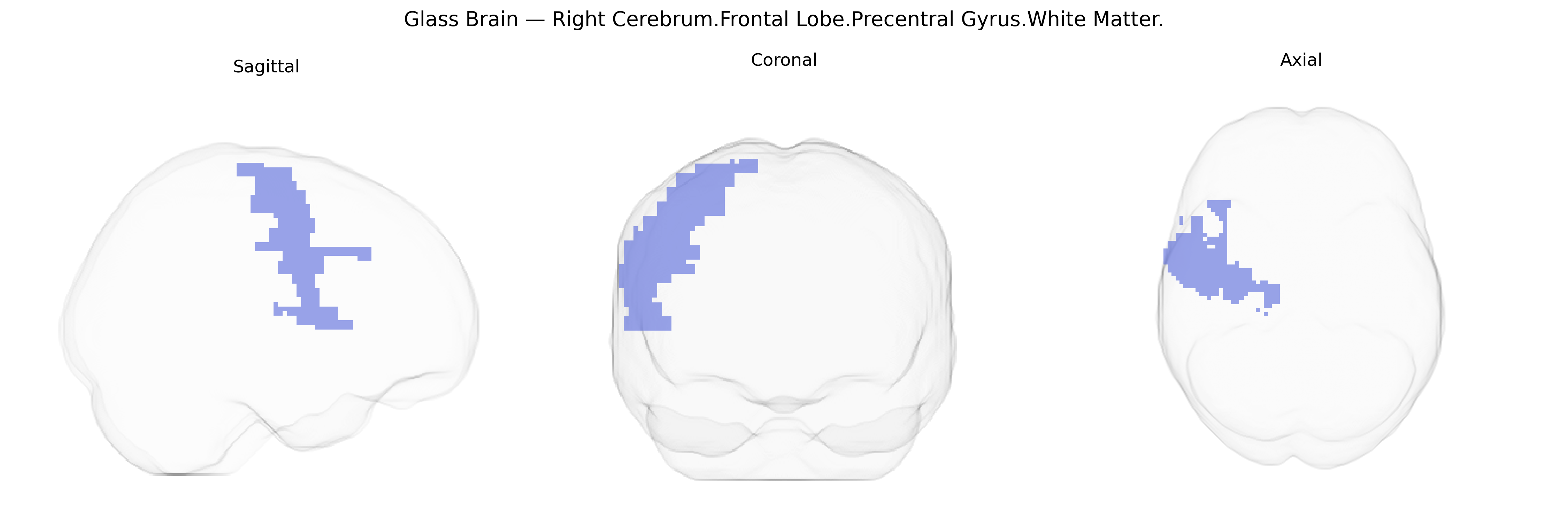 Triplanar Ghost Brain