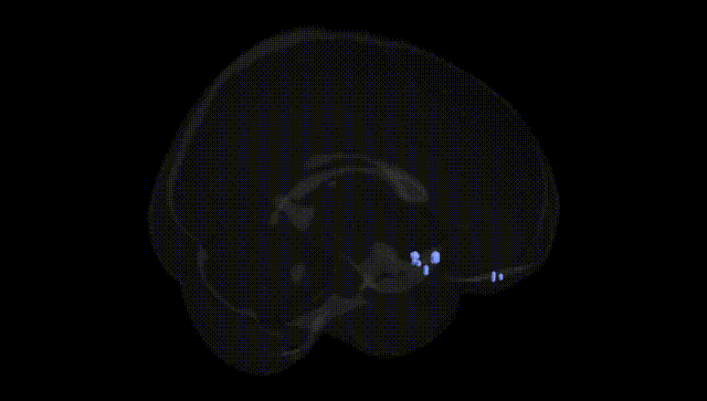 Full Brain Black