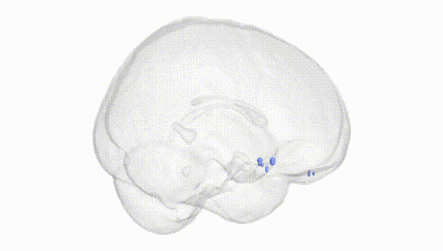 Full Brain White