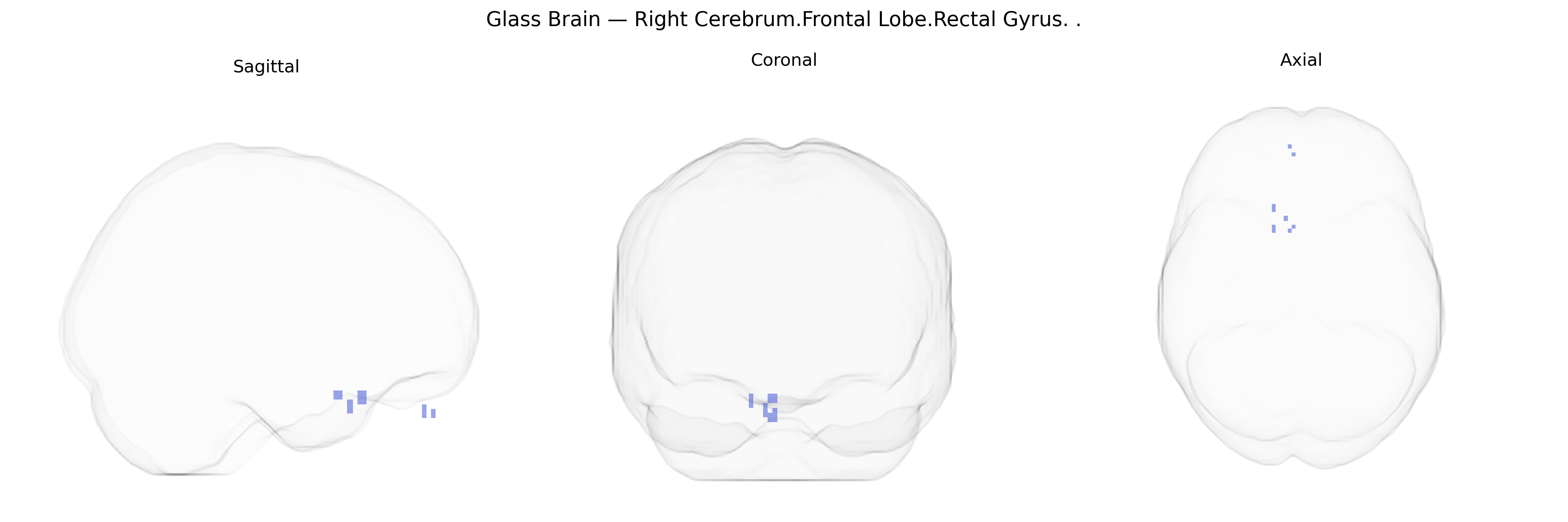 Triplanar Ghost Brain