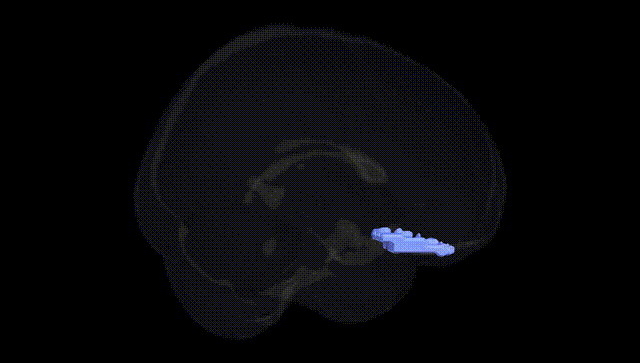 Full Brain Black