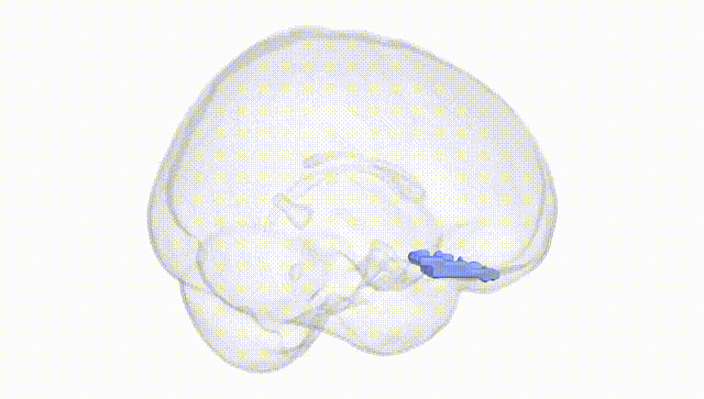 Full Brain White