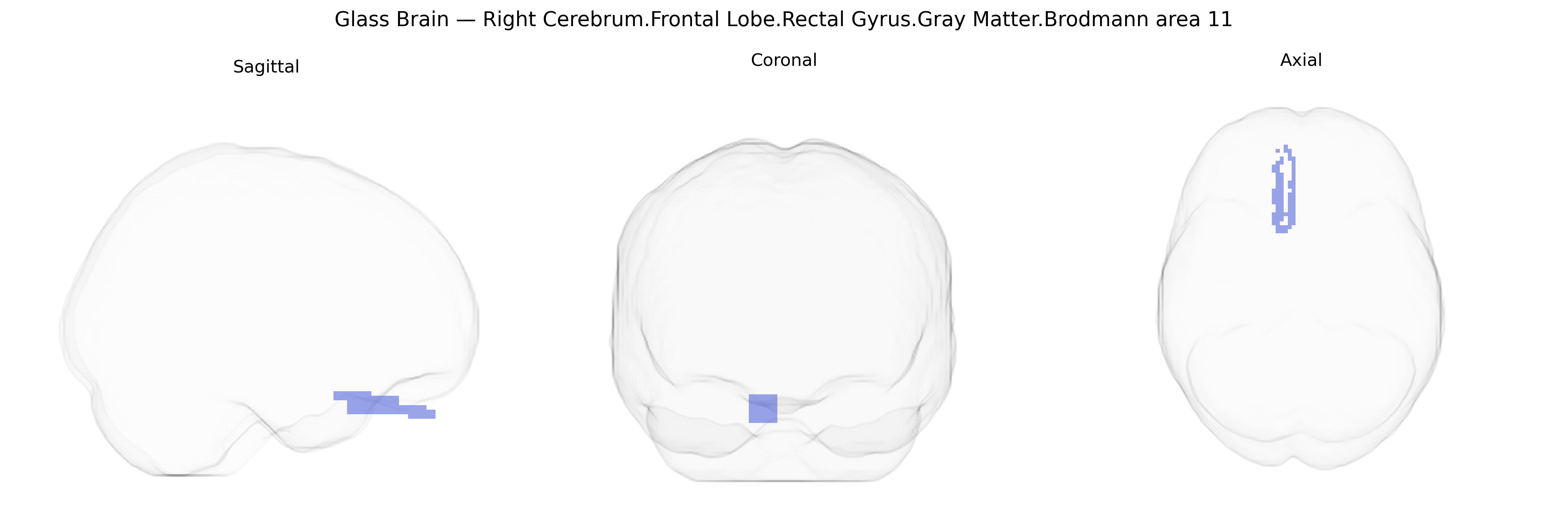 Triplanar Ghost Brain