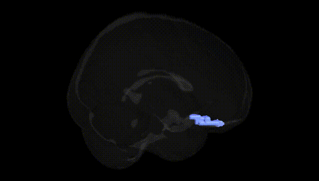 Full Brain Black