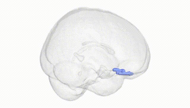 Full Brain White