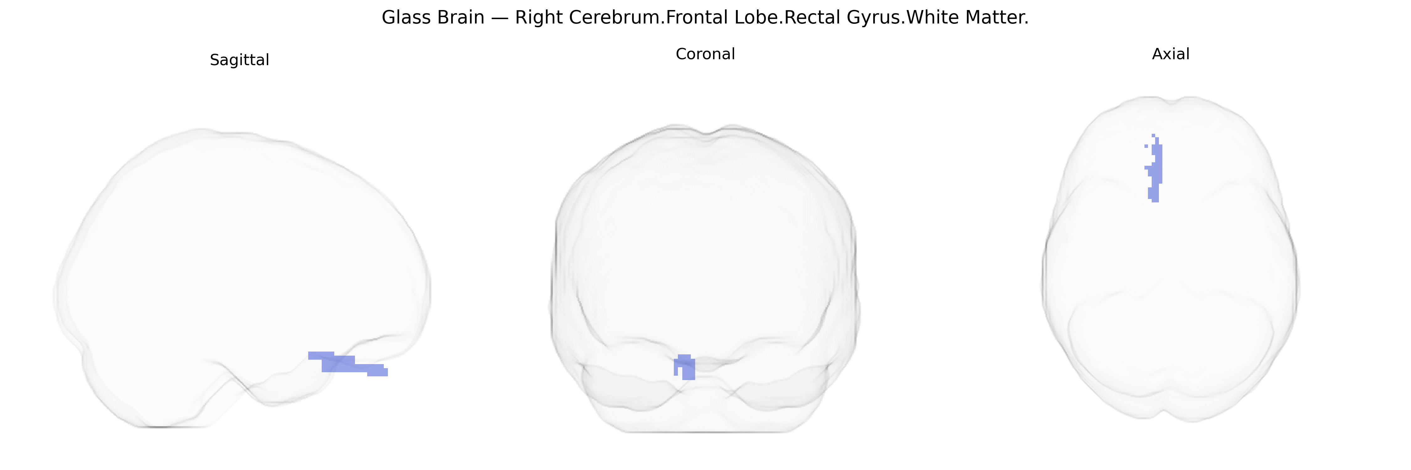 Triplanar Ghost Brain