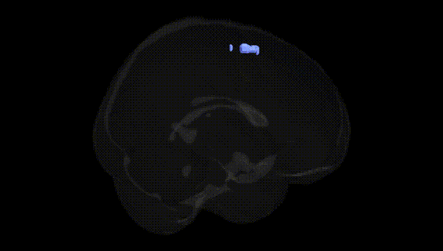 Full Brain Black