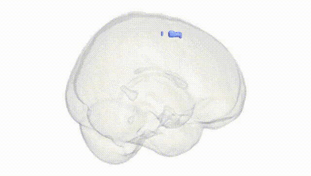 Full Brain White