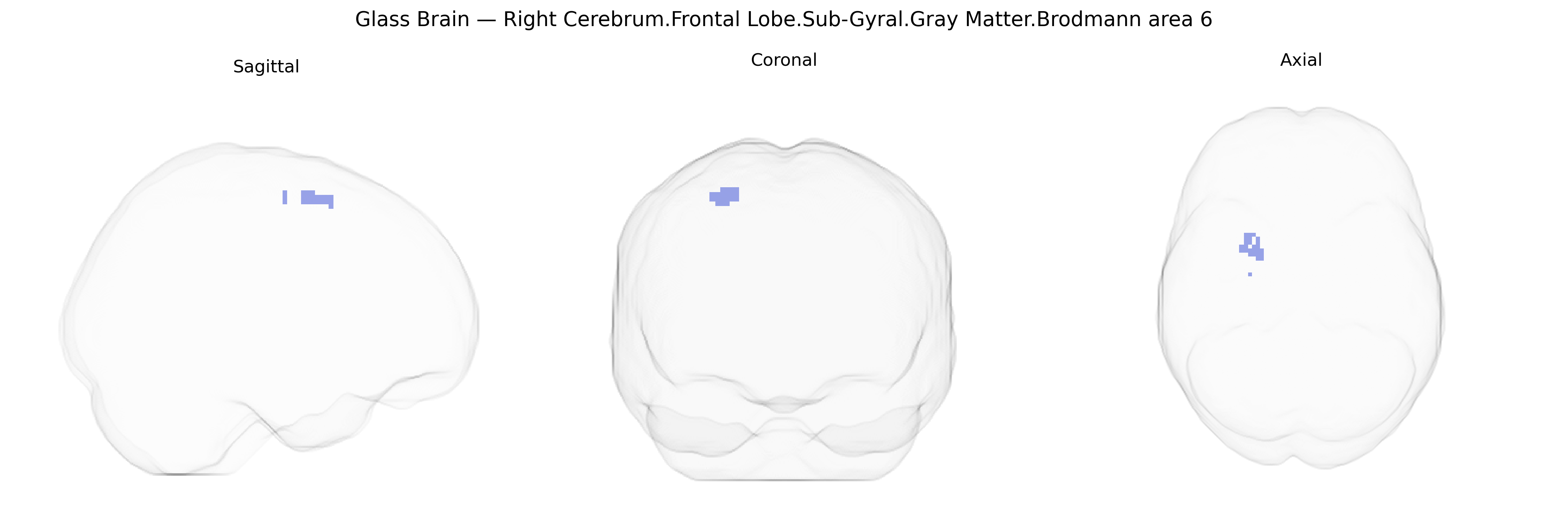 Triplanar Ghost Brain