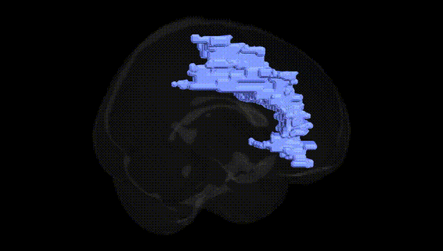 Full Brain Black