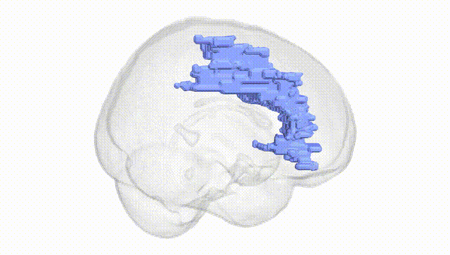 Full Brain White
