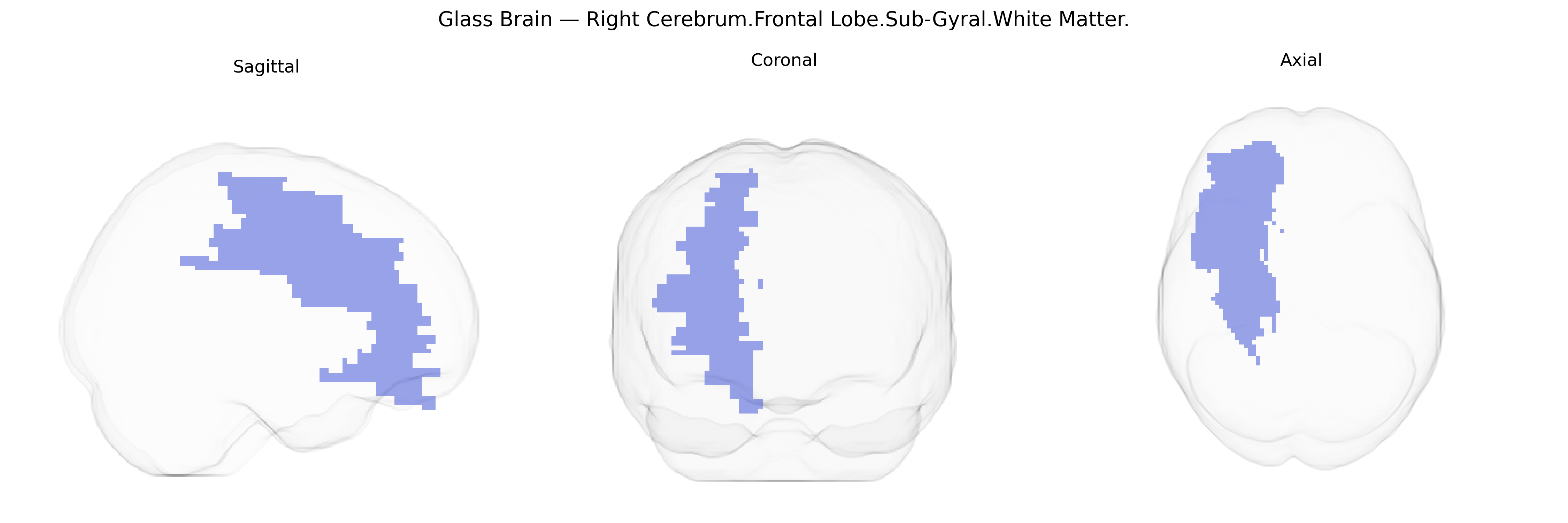 Triplanar Ghost Brain