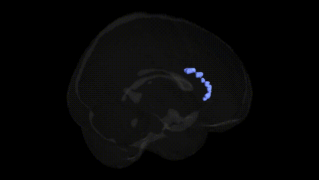 Full Brain Black