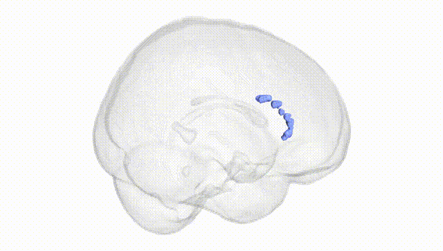 Full Brain White