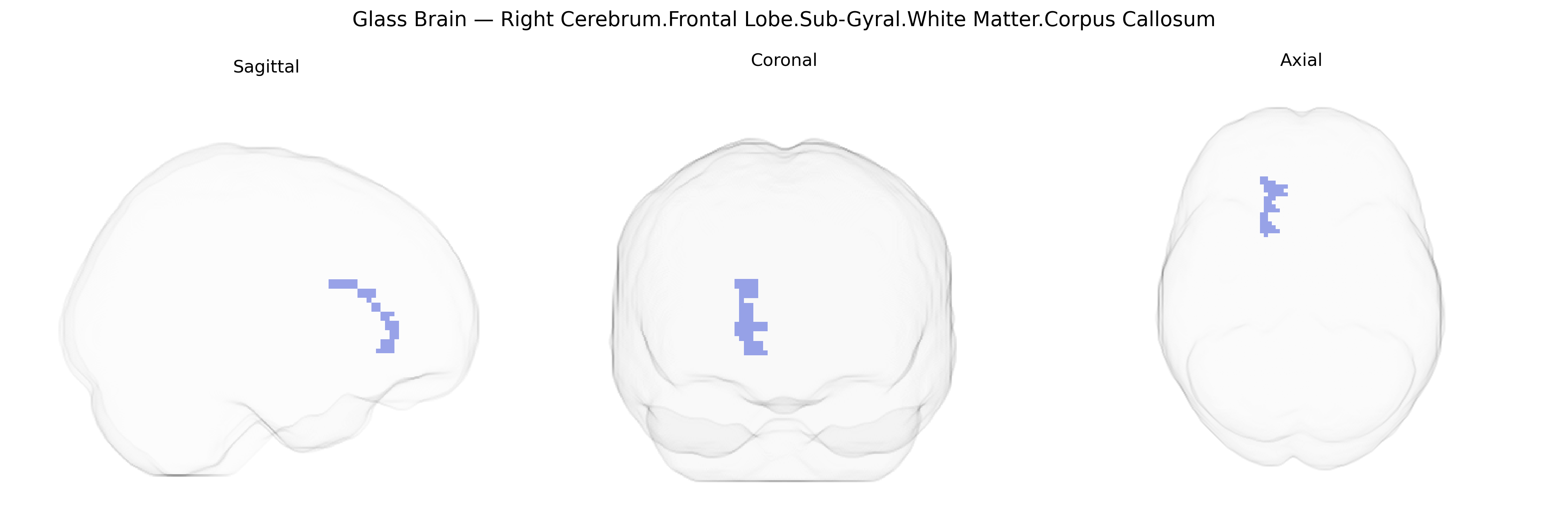Triplanar Ghost Brain
