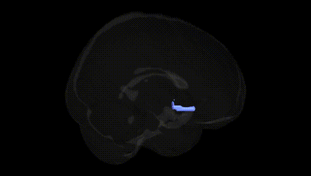 Full Brain Black
