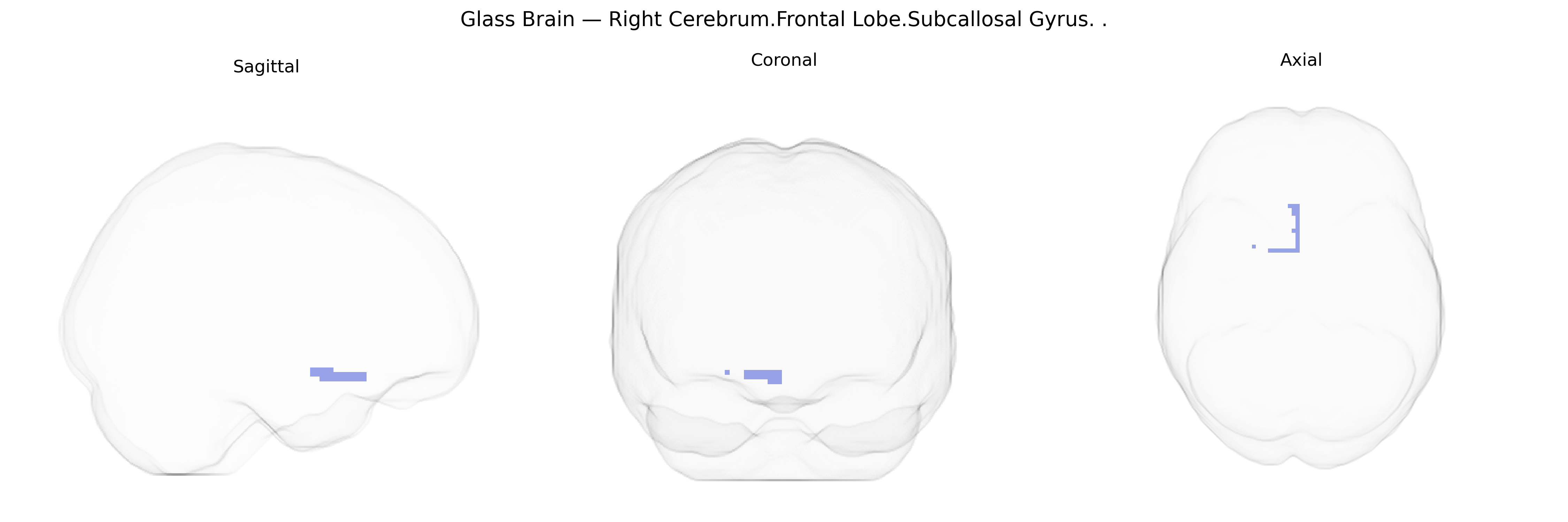 Triplanar Ghost Brain