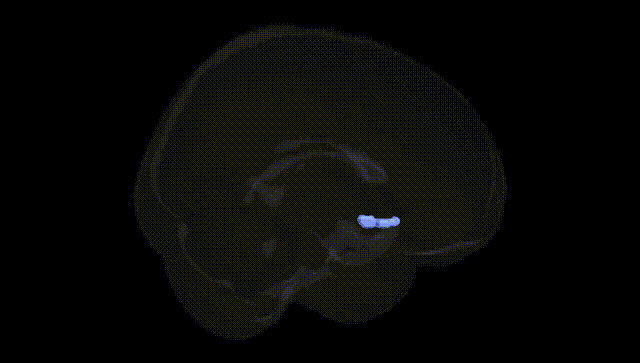 Full Brain Black