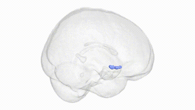 Full Brain White