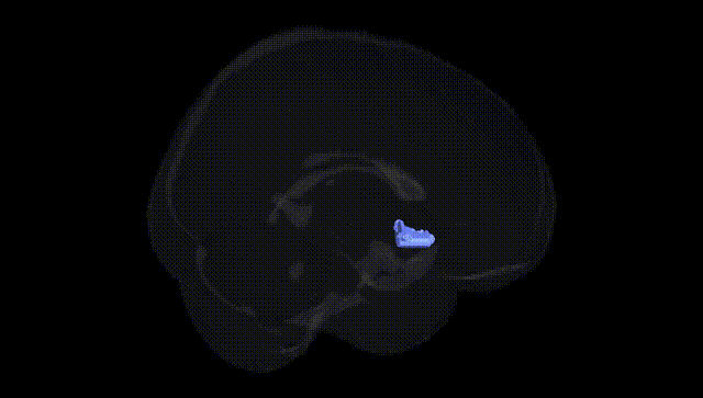 Full Brain Black
