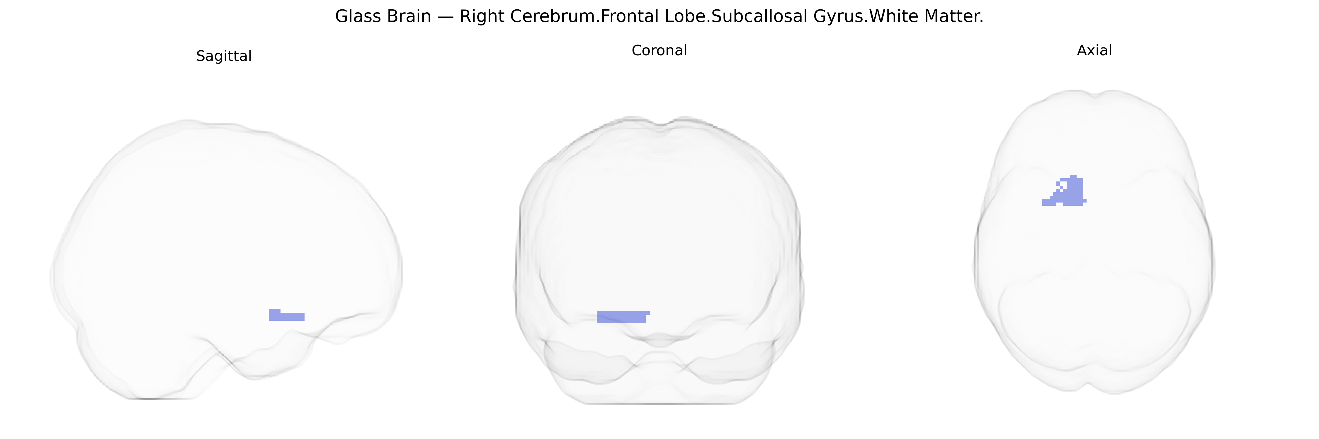 Triplanar Ghost Brain