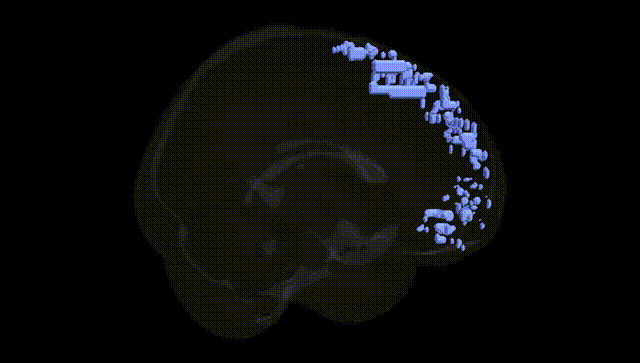 Full Brain Black