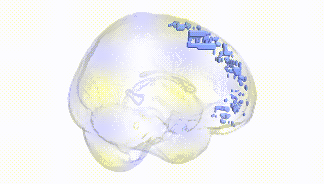 Full Brain White