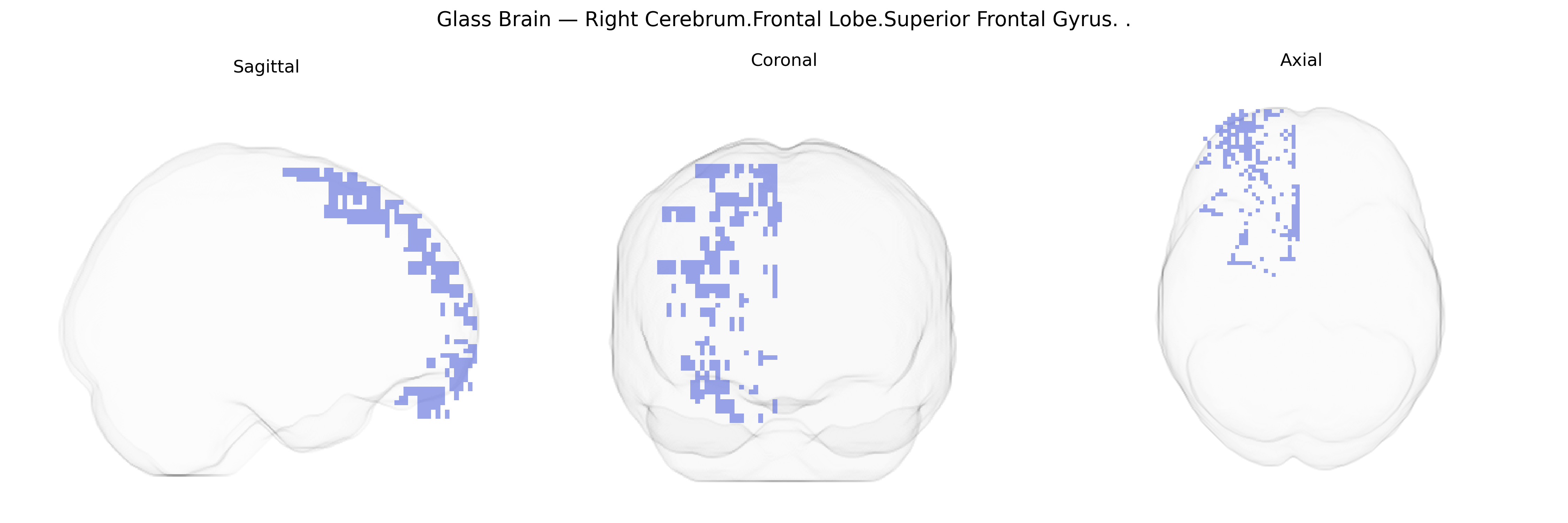 Triplanar Ghost Brain
