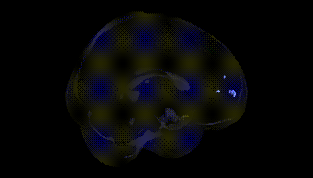 Full Brain Black