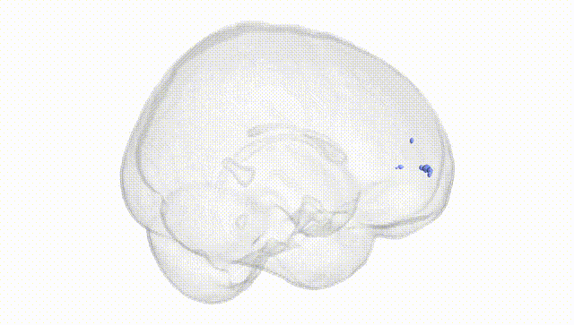 Full Brain White