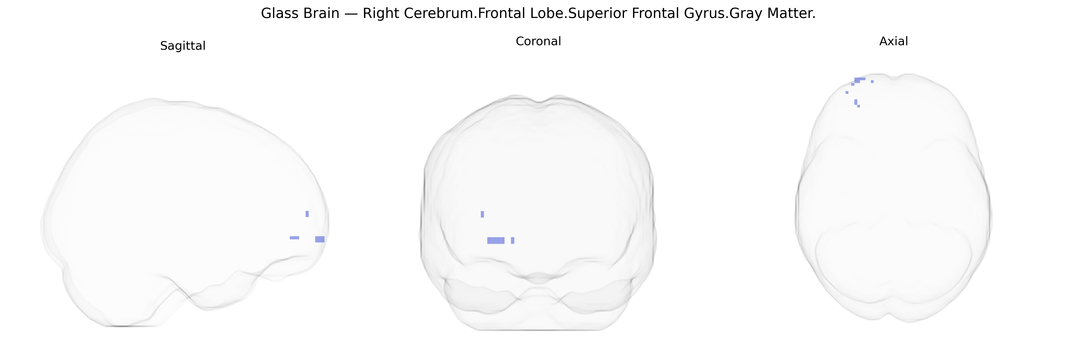 Triplanar Ghost Brain