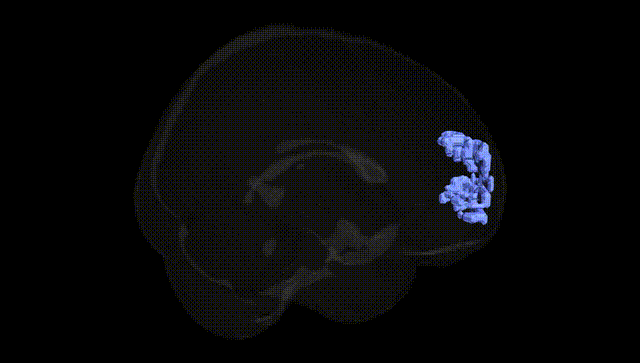 Full Brain Black