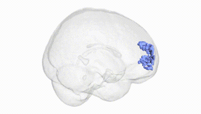 Full Brain White
