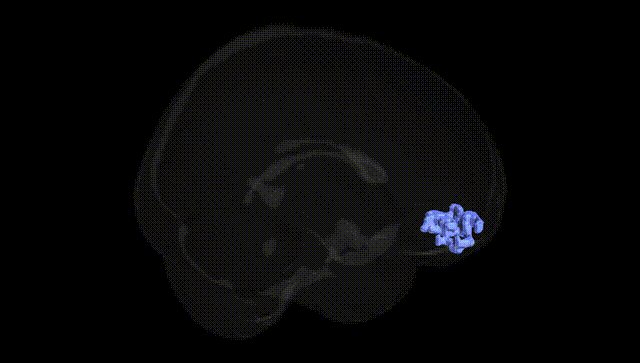 Full Brain Black