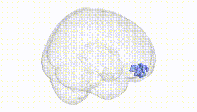 Full Brain White