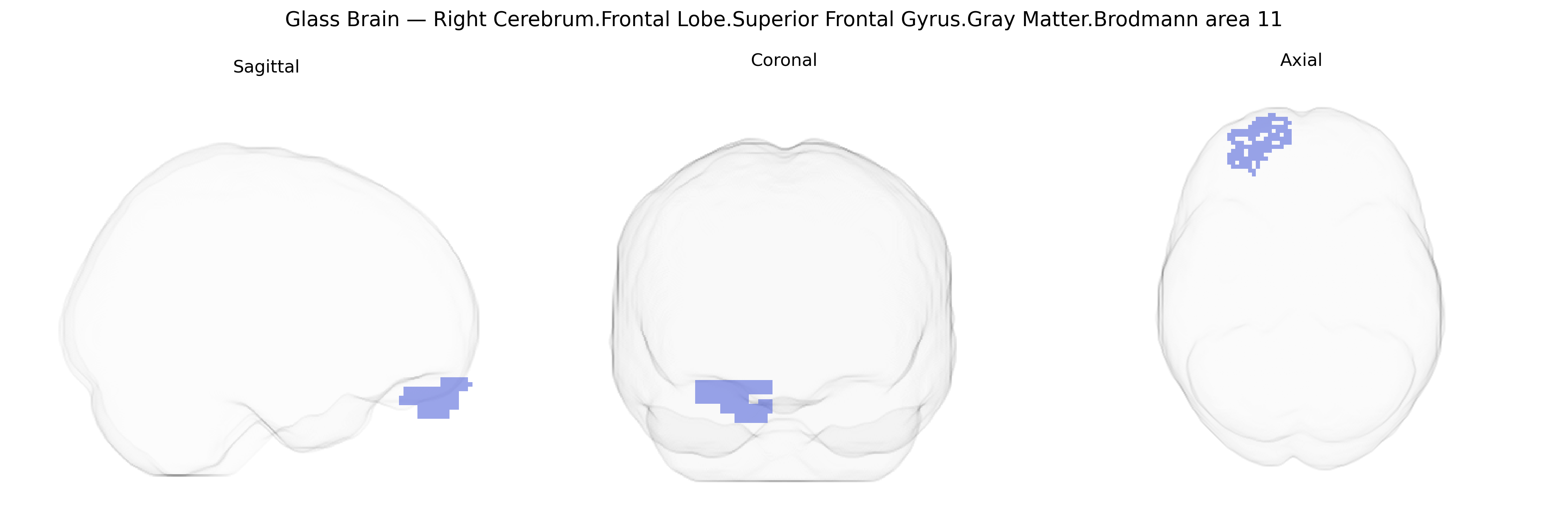 Triplanar Ghost Brain
