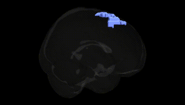 Full Brain Black