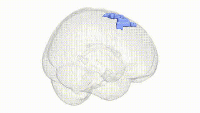 Full Brain White