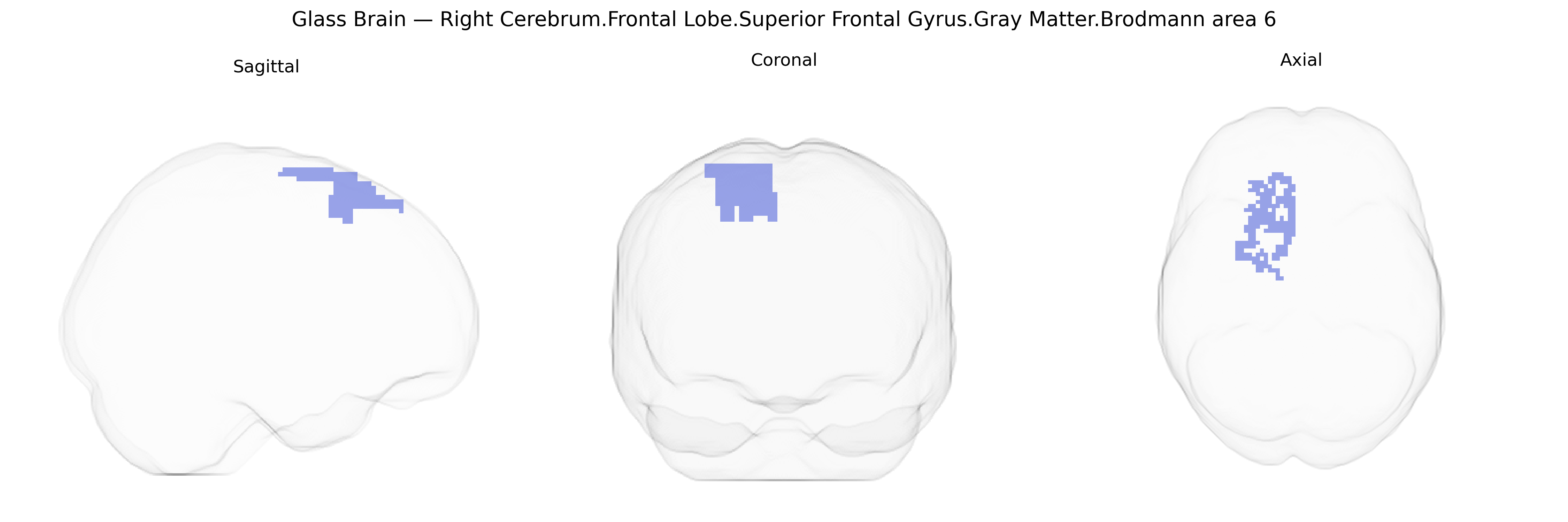Triplanar Ghost Brain