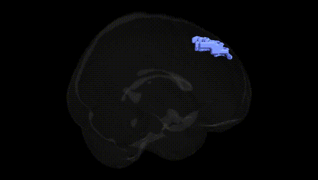 Full Brain Black