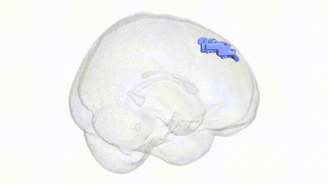 Full Brain White