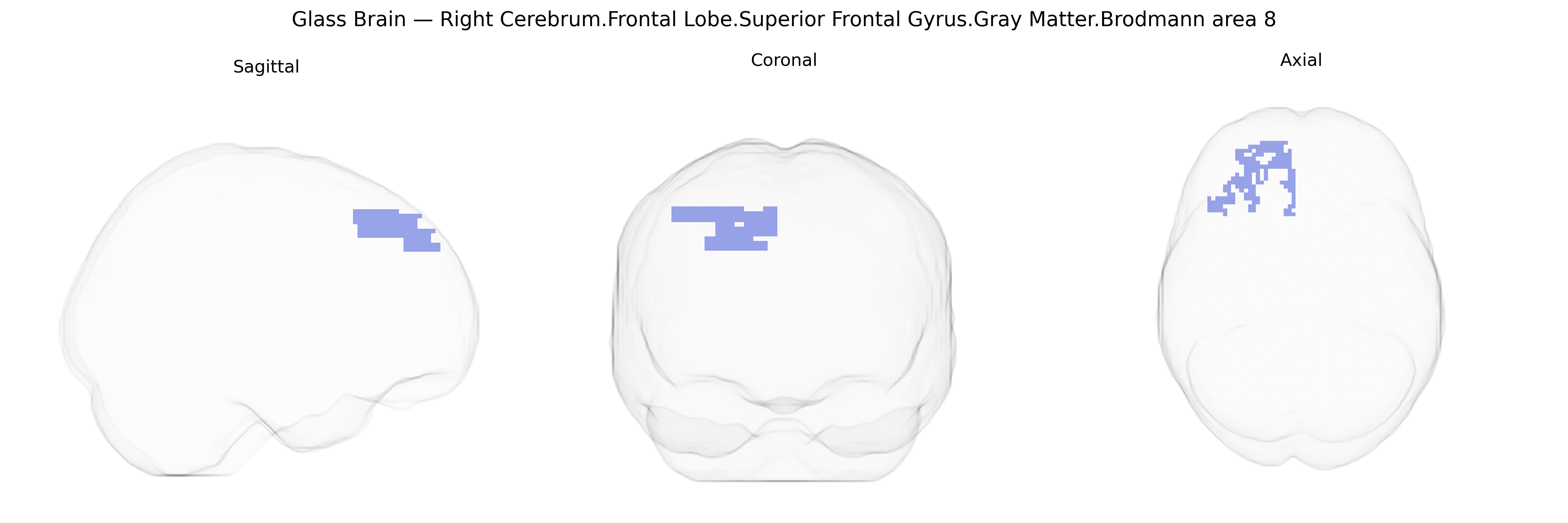 Triplanar Ghost Brain