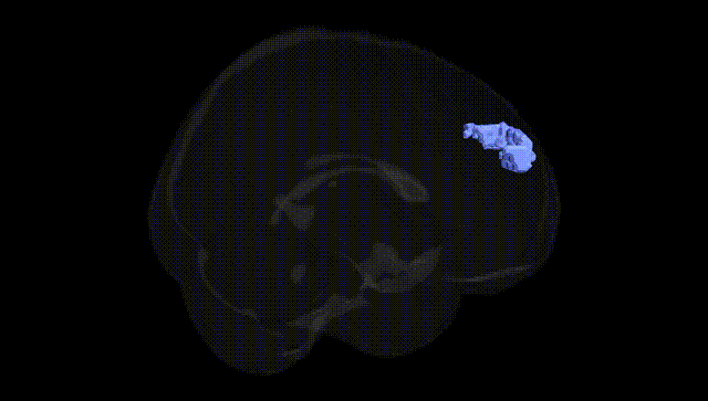 Full Brain Black