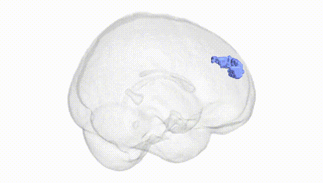 Full Brain White