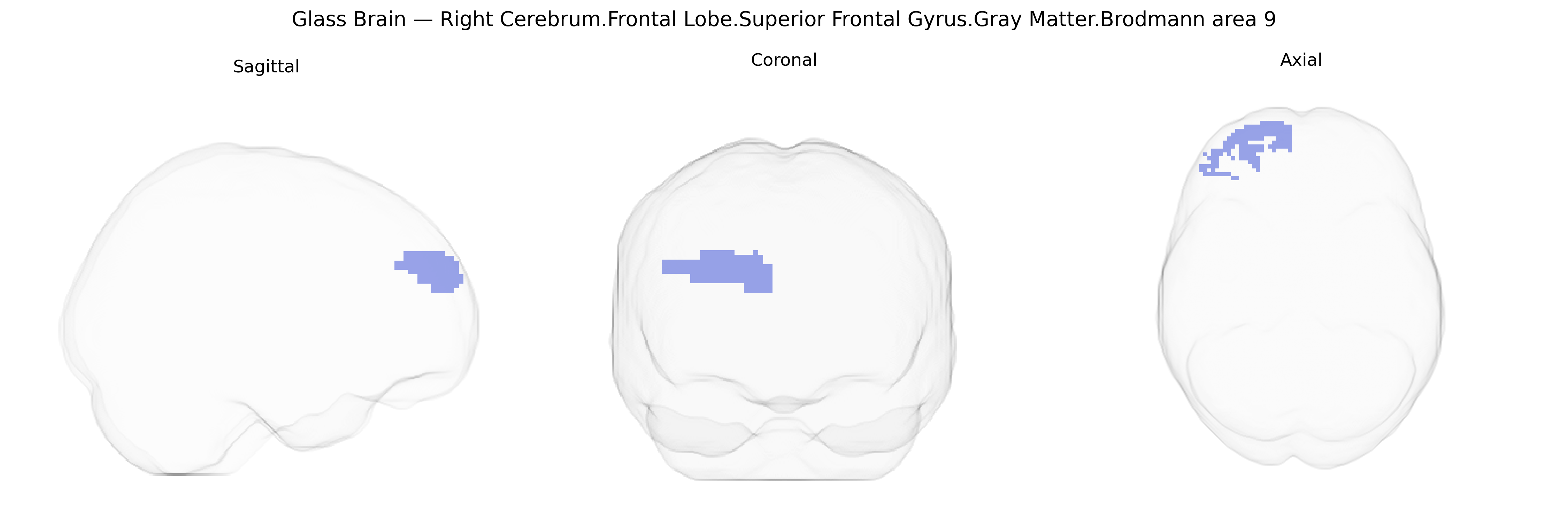 Triplanar Ghost Brain
