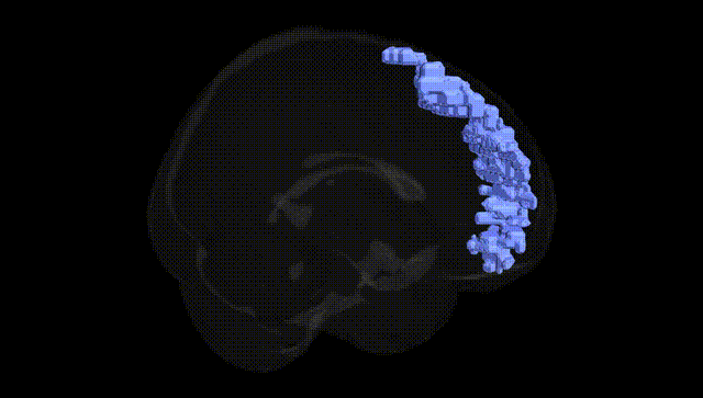 Full Brain Black